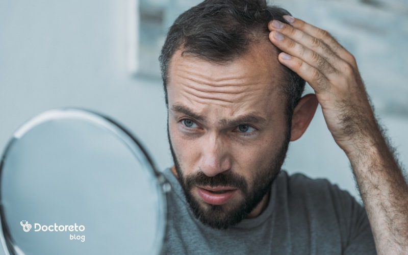 شایع‌ترین علت ریزش مو در مردان چیست؟