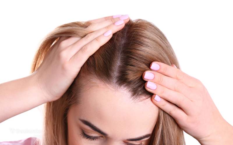 کدام قرص‌ ها عامل ریزش مو هستند؟