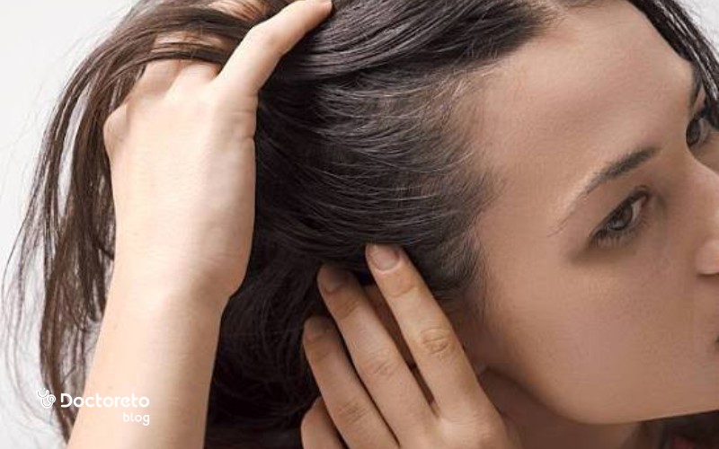 مصرف سوپراکل برای ریزش مو تا چه مدت باید ادامه پیدا کند؟